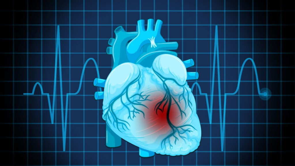 గుండెపోటు మరణాల్లో 20% భారత్‌లోనే!