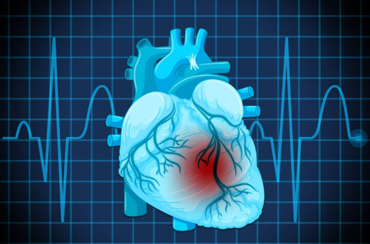 గుండెపోటు మరణాల్లో 20% భారత్‌లోనే!